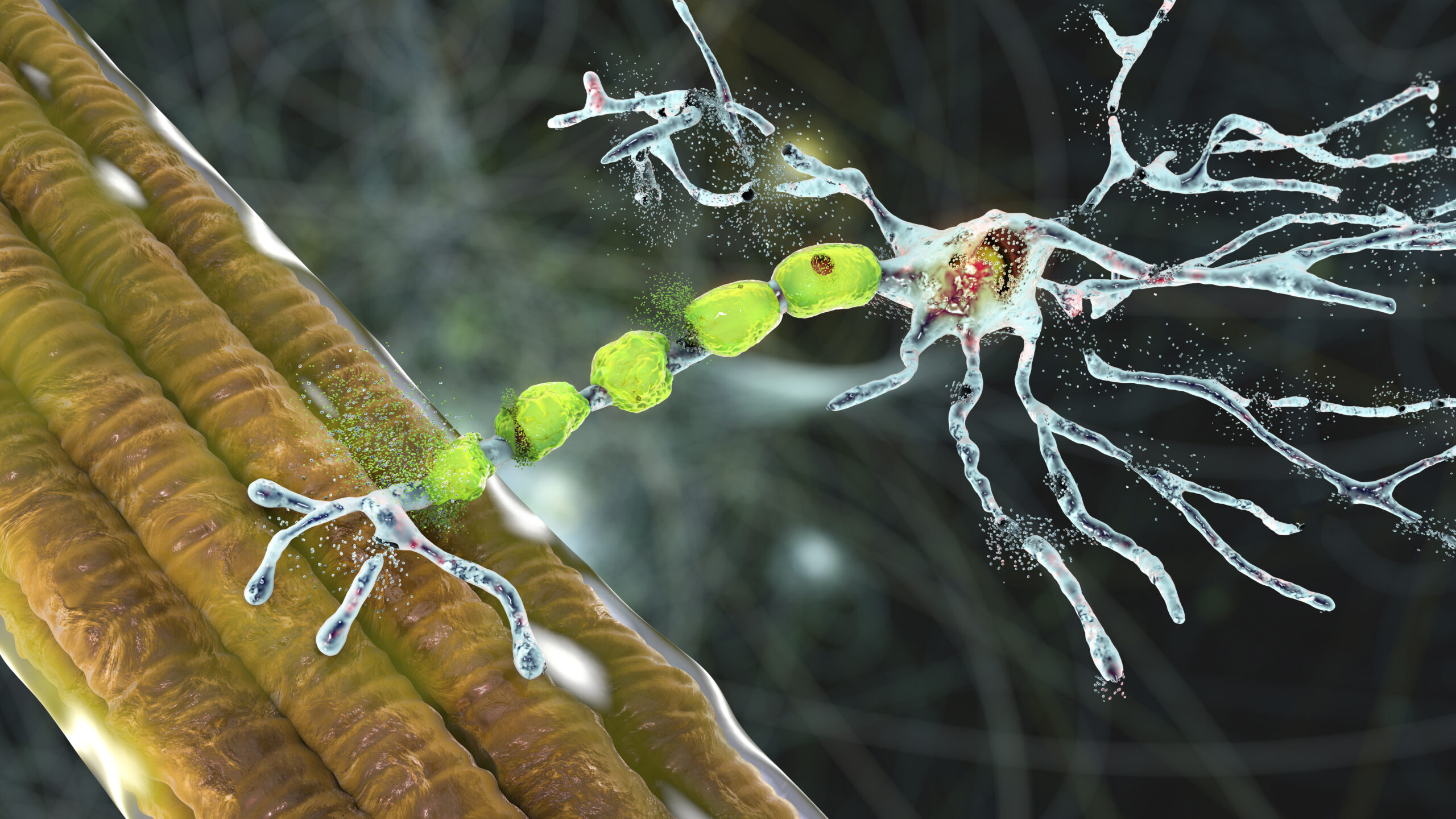 Degradation of motor neurons, conceptual 3D illustration.