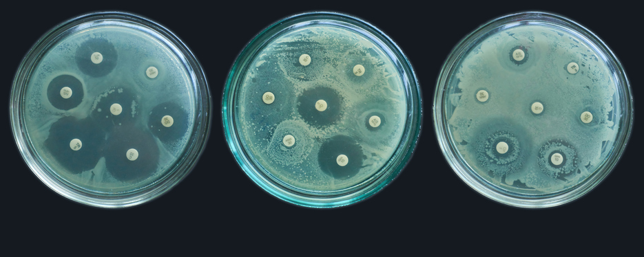 Three petri dishes